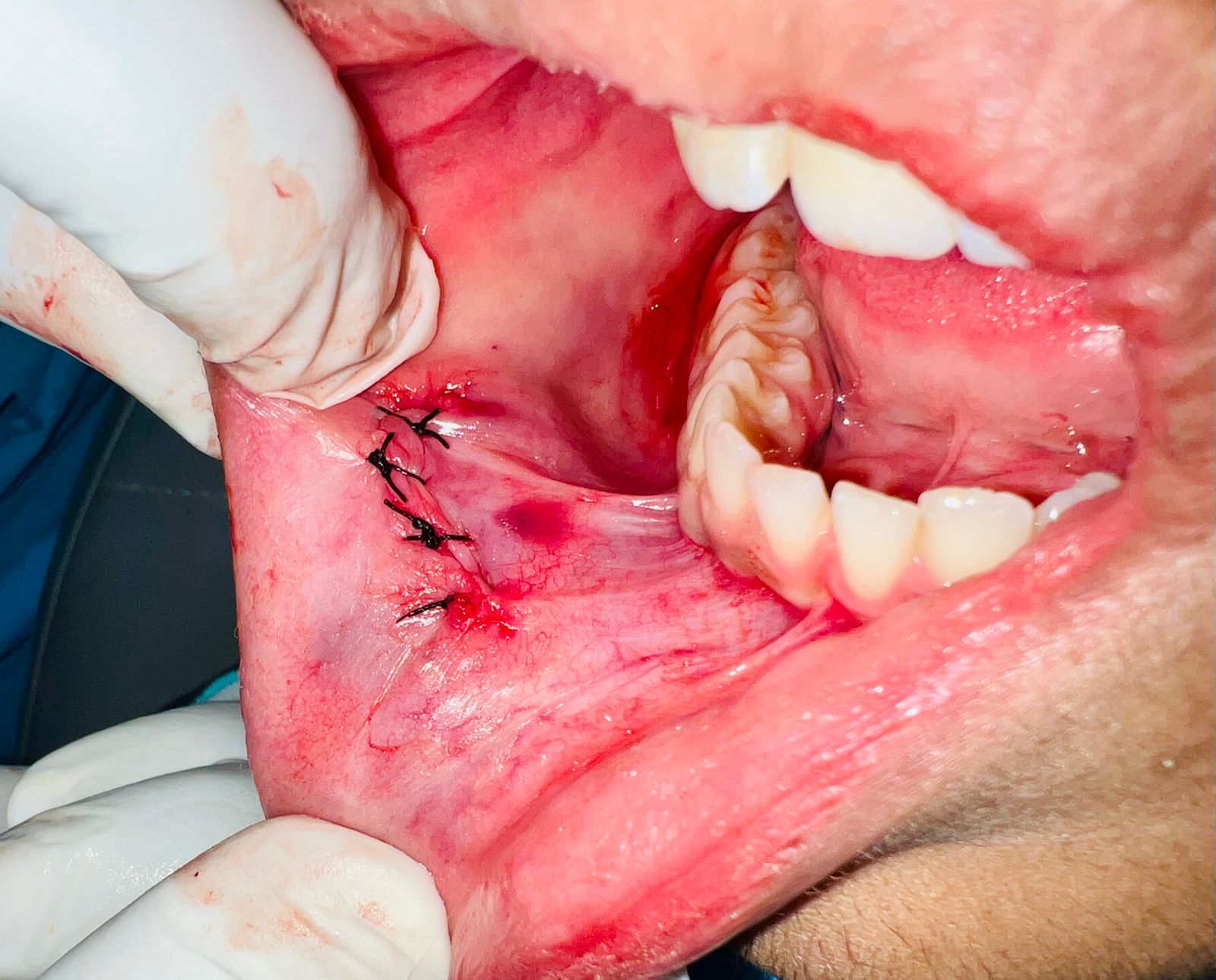 our team member & renowned maxillofacial surgeon DR.ANUDEEP GUPTA whatsapp image 2026 08 23 at 10.13.23 pm (1)