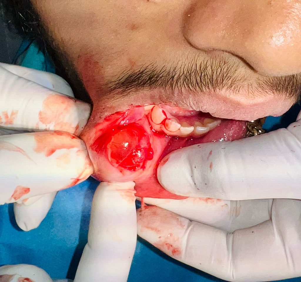 our team member & renowned maxillofacial surgeon DR.ANUDEEP GUPTA whatsapp image 2026 08 23 at 10.13.24 pm (1)