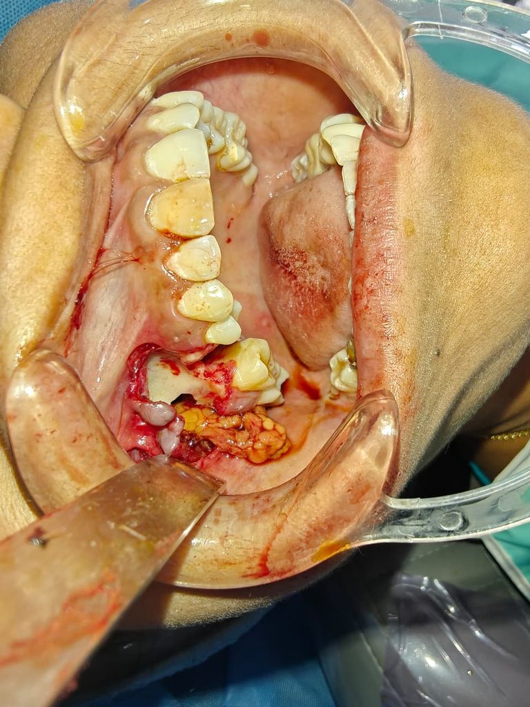 our team member & renowned maxillofacial surgeon DR.ANUDEEP GUPTA whatsapp image 2026 08 23 at 10.13.25 pm (1)