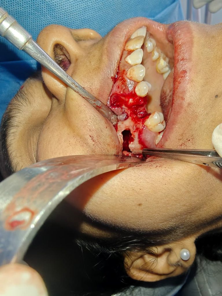 our team member & renowned maxillofacial surgeon DR.ANUDEEP GUPTA whatsapp image 2026 08 23 at 10.13.31 pm (1)